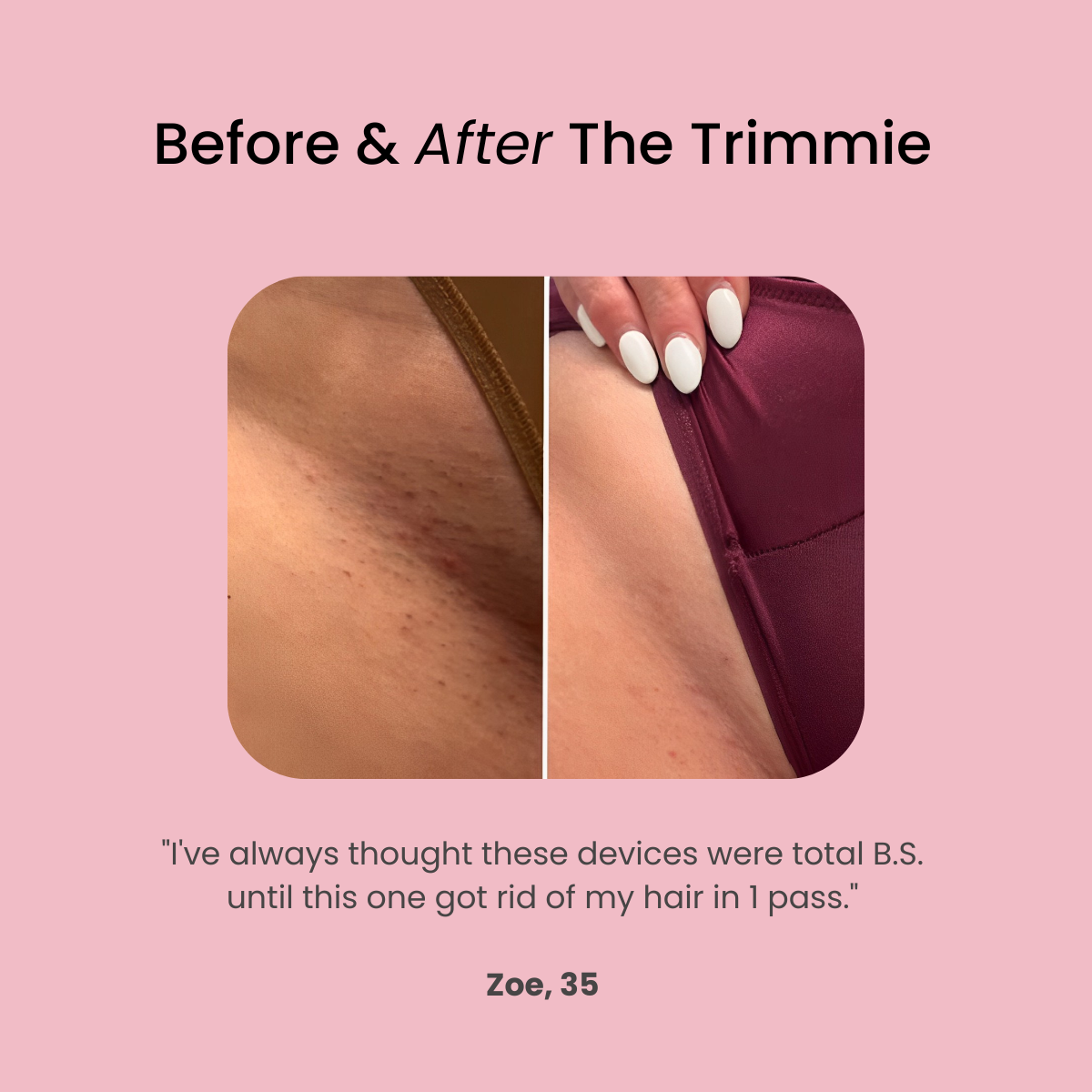 TrimLuxe - The Smooth Shave Solution