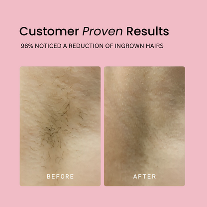 TrimLuxe - The Smooth Shave Solution